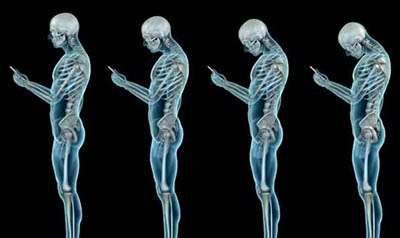 Le Tech Neck : quand le smartphone devient un risque professionnel